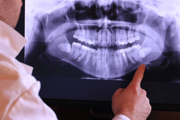Best Emergency Denture Repair in Houston, MO